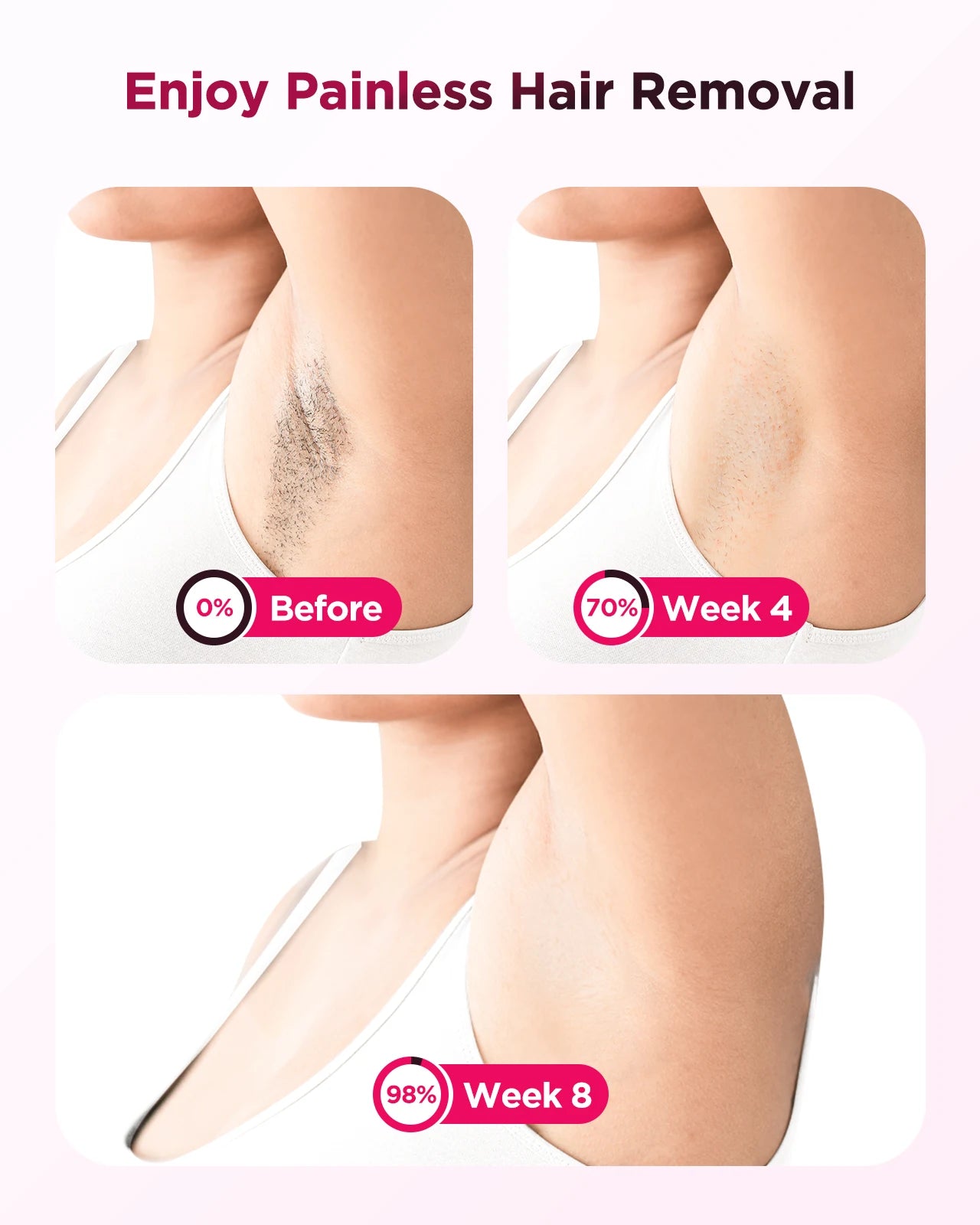 IPL Laser Hair Removal Device Ice-Cooling 3 in 1 Painless 16J Photoepilator Permanent Whole Body Home Treament for Men and Women